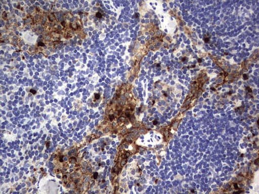 CEACAM5 / CD66e Antibody (aa35-680, clone OTI1C2)
