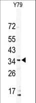Polyclonal Rabbit anti-Human DSCR3 Antibody (aa1-30, WB)