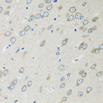 OGDH Antibody
