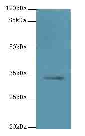 Polyclonal Rabbit anti-Human C5orf35 Antibody (WB)