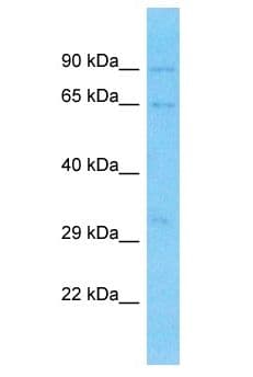 FAM117B / ALS2CR13 Antibody (aa530-579)