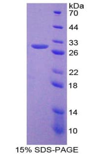 Human NUP155 Protein (Recombinant His-T7)