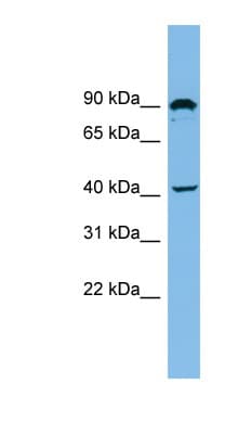 ZMYND12 Antibody (aa35-84)