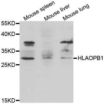 HLA-DPB1 Antibody