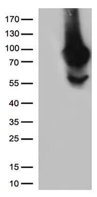 MTHFR Antibody (aa1-230, clone OTI2H3, Carrier-free)