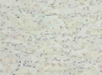 TSPAN33 / PEN Antibody