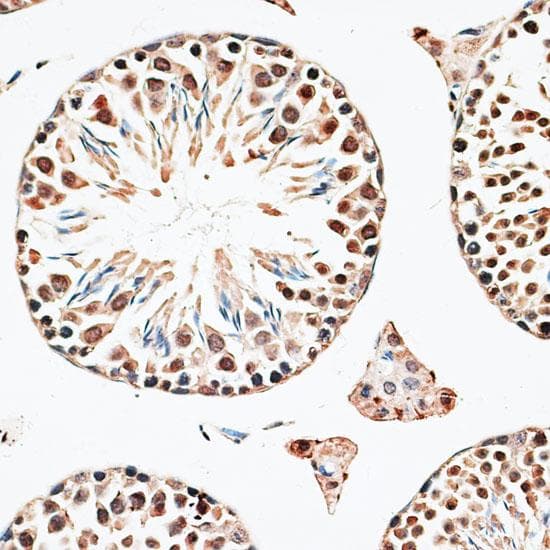 CBX6 Antibody