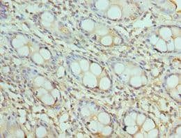 AKTIP / FTS Antibody (aa1-292)