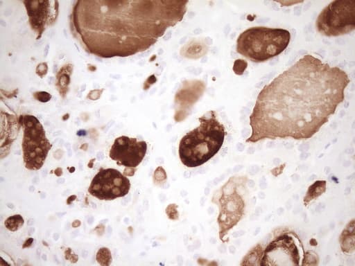 Monoclonal Mouse anti-Human MMP3 Antibody (clone OTI2H6, Carrier-free, aa246-477, IHC, WB)