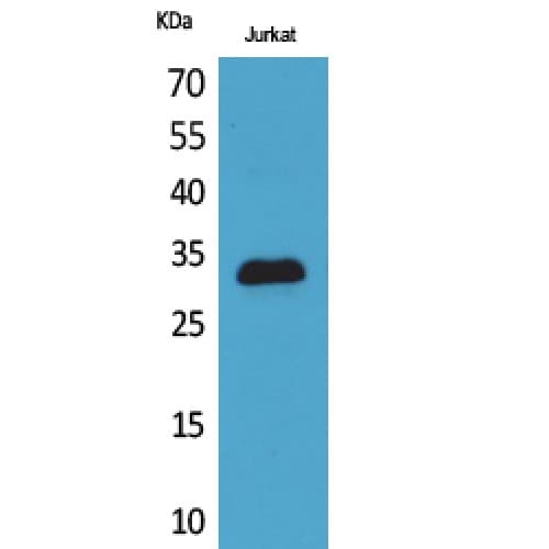 CDKN1C / p57 Kip2 Antibody