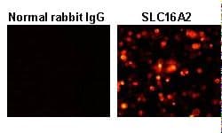 SLC16A2 / MCT8 Antibody (N-Terminal)