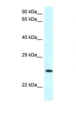 WWOX Antibody (aa95-144)