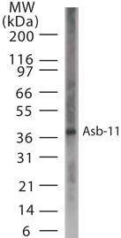 Polyclonal Rabbit anti-Human ASB11 Antibody (aa40-51, WB)