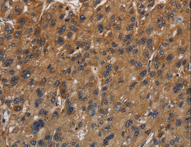 ITGB7 / Integrin Beta 7 Antibody