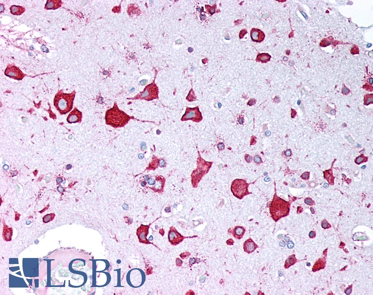 IHC-plus™ Polyclonal Rabbit anti-Human NEDL2 / HECW2 Antibody (Internal, IHC, IF, WB)