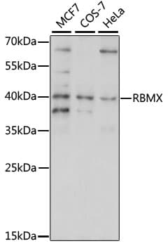 RBMX Antibody