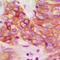 CALM1 / Calmodulin Antibody (phospho-Thr80/Ser82)