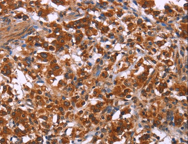 ING2 Antibody