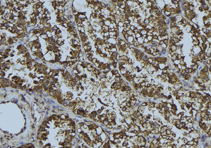 HMOX2 / Heme Oxygenase 2 Antibody