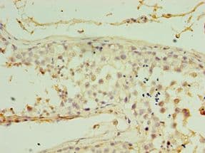 Polyclonal Rabbit anti-Human RDM1 Antibody (aa125-284, IHC, WB)