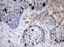 Monoclonal Mouse anti-Human TOP2A / Topoisomerase II Alpha Antibody (clone OTI2F8, aa1100-1531, IHC, WB)