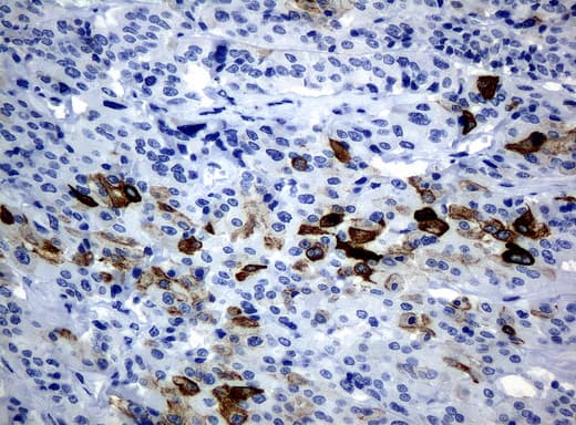Monoclonal Mouse anti-Human KRT19 / CK19 / Cytokeratin 19 Antibody (clone UMAB2, Carrier-free, aa240-390, IHC, IF, WB)