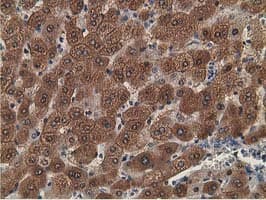 ADH2 / ADH1B Antibody (clone OTI5D7)