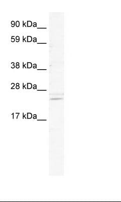 ASCL2 Antibody (aa146-195)