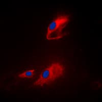 ACOT8 Antibody (Internal)