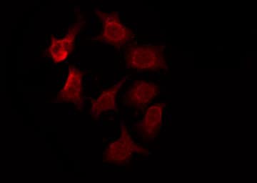 OR2T2 + OR2T35 Antibody