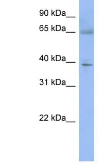 ZNF302 Antibody (N-Terminus)
