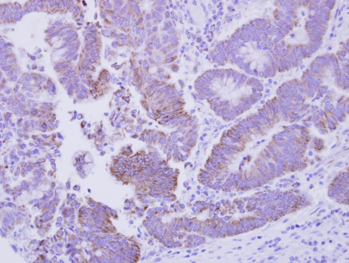 Polyclonal Rabbit anti-Drosophila CG1458 Antibody (IHC, WB)