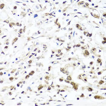 Polyclonal Rabbit anti-Human HIRA Antibody (IHC, WB)