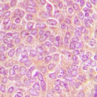 CLASP1 Antibody (C-Terminus)