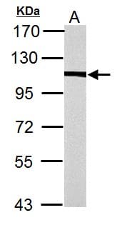 ACTN4 Antibody (aa206-542)