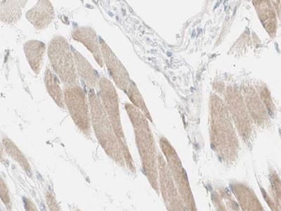 NDUFC2 Antibody