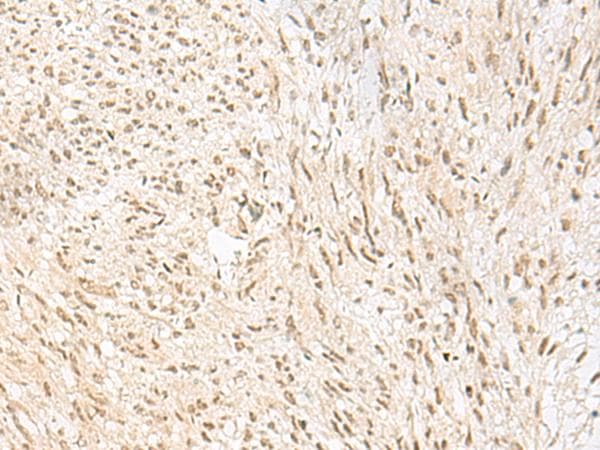 PSPC1 Antibody