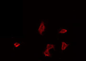 Polyclonal Rabbit anti-Human F2R / Thrombin Receptor / PAR1 Antibody (IF, WB)