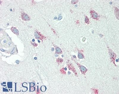 IHC-plus™ GBA / Glucosidase Beta Acid Antibody