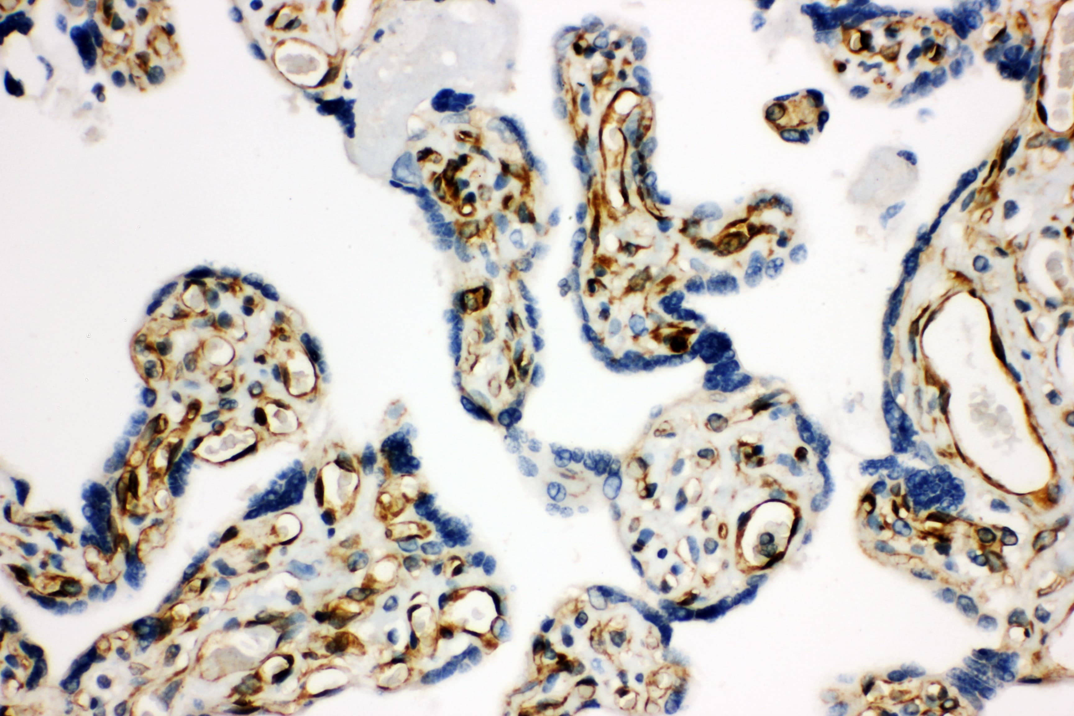 Polyclonal Rabbit anti-Human HSD17B2 Antibody (aa373-387, IHC, WB)
