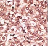 Polyclonal Rabbit anti-Human TLR6 Antibody (aa393-423, IHC, WB)