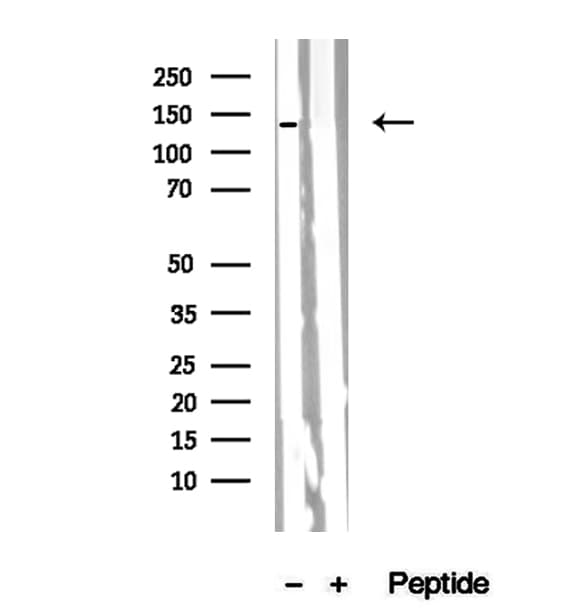 Polyclonal Rabbit anti-Human PER2 Antibody (IHC, IF, WB)