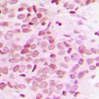 MED12 Antibody (Internal)