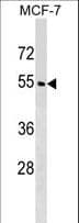 WDR20 Antibody (aa5-32)