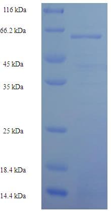Human SKP2 Protein (Recombinant 6His-SUMO, N-terminus)