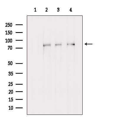 FLCN / Folliculin Antibody
