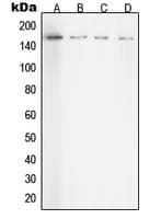 Rho Kinase / ROCK1 Antibody (Internal)