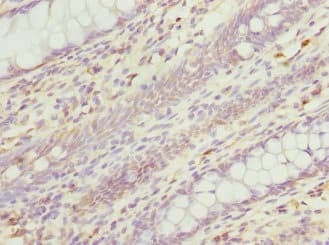 Polyclonal Rabbit anti-Human RGS5 Antibody (IHC)