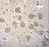 OR4K2 Antibody (aa276-304)