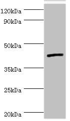 IL13RA2 / IL13R Alpha 2 Antibody (aa27-343)
